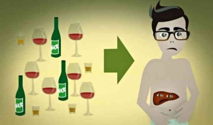 أضرار المشروبات الكحولية على الكبد