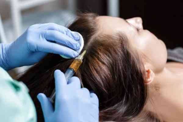 علاج الشعر بالبلازما