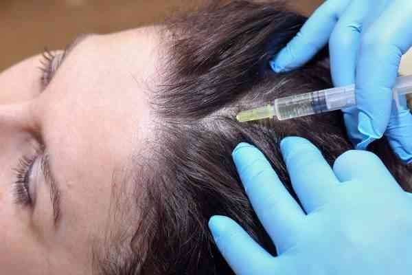 علاج الشعر بالبلازما