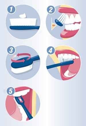 طريقة تنظيف الأسنان 