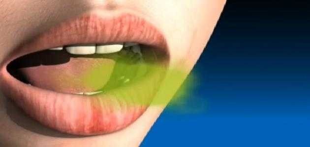 غسول الفم