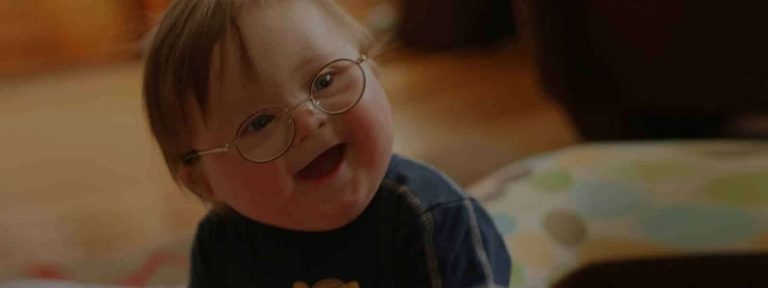 مضاعفات متلازمة داون 