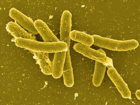 ما هي بكتيريا السالمونيلا 