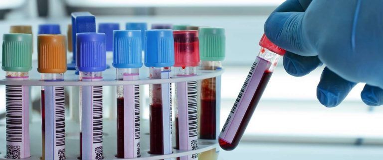 اختبارات كيمياء الدم \ Blood Chemistry Tests