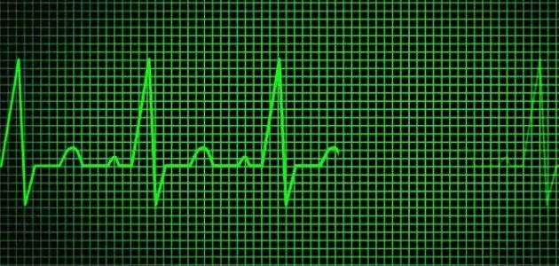 متى يحتاج الطبيب رسم لكهرباء القلب ..