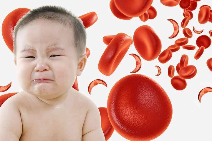 علاج فقر الدم عند الاطفال