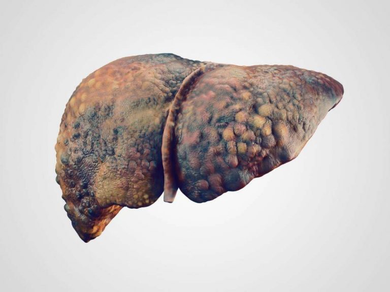 مضاعفات مرض الكبد سي