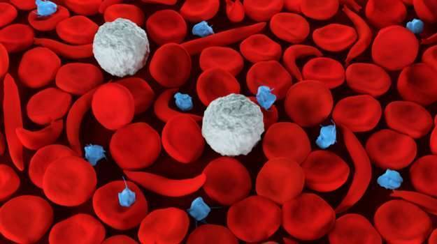 فقر الدم الناجم عن تدمير خلايا الدم الحمراء