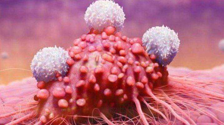 أسباب الإصابة بالسرطان - مقال عن السرطان