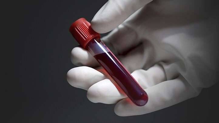ما هي الحالات التي يلرم فيها عمل تحليل تجلط الدم؟