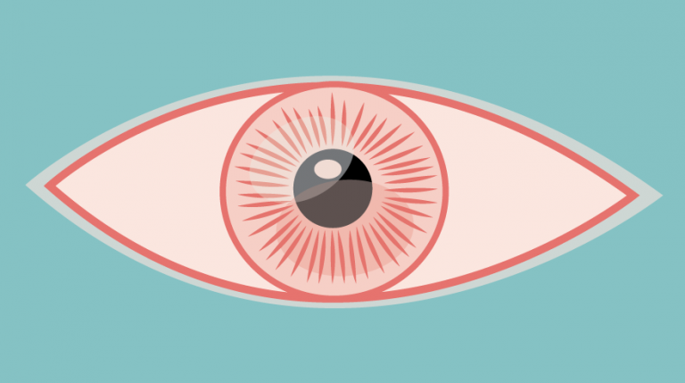أعراض رمد العين | معلومات