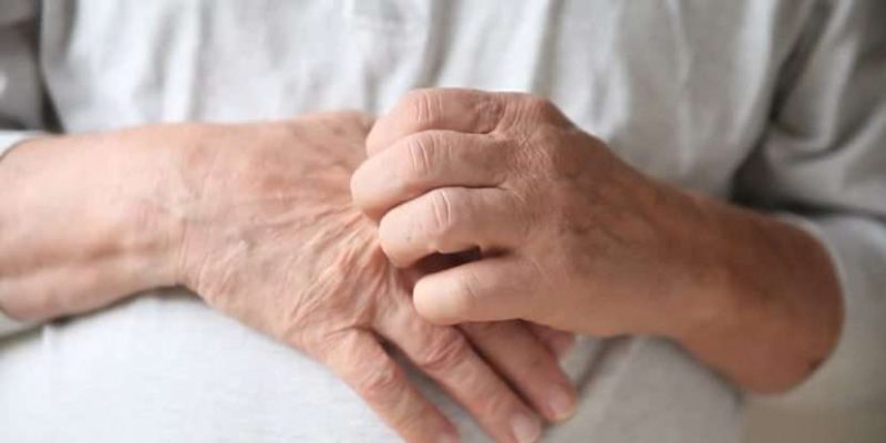 حكة وملتهبة الجلد (الأكزيما) ..