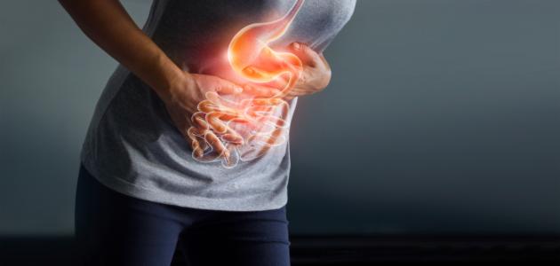 علاج قرحة المعدة