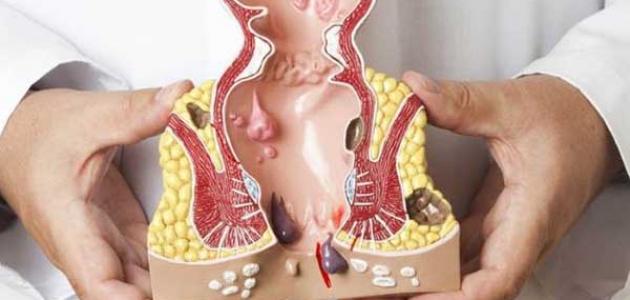 فوائد زيت النعناع للبواسير