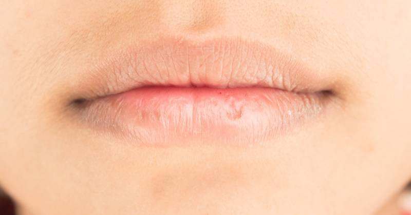 وصفات طبيعية لتفتييح حول الفم