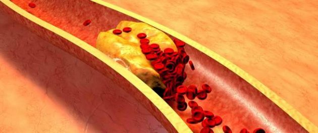 كبسولات ريغيوليب لتقليل الكوليسترول في الدم Regulib