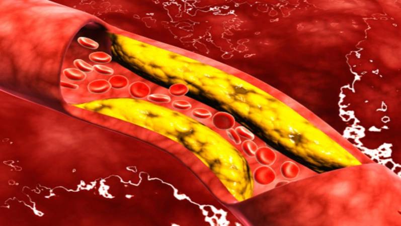 كبسولات ريغيوليب لتقليل الكوليسترول في الدم Regulib