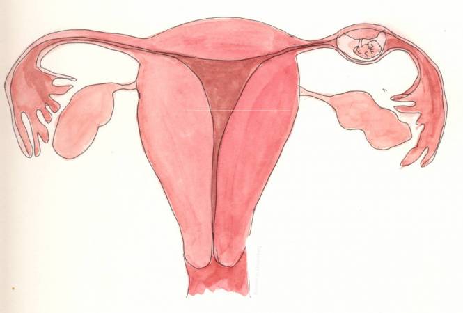أعراض الحمل خارج الرحم3