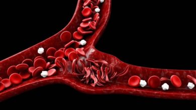 ماهو فقر الدم المنجلي وما انواعه واسبابه وطرق علاجه
