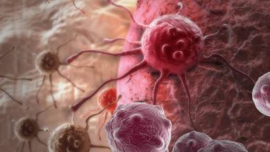 هل السرطان وراثي وما اسبابه وعلاجه