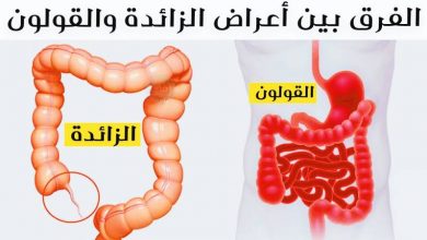 الفرق بين اعراض الزائدة الدودية والقولون4