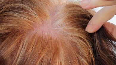 طرق علاج الشعر المحروق وحلول لإصلاح الشعر التالف والمتقصف موقع المعلومات
