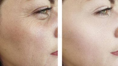 woman wrinkles face beautician effect therapydifference regeneration treatments woman wrinkles face 144903267