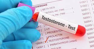 ماذا تريد أن تعرف عن انخفاض هرمون التستوستيرون؟
