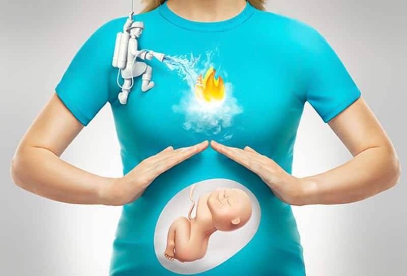 حرقة المعدة عند الحامل وجنس الجنين موقع المعلومات