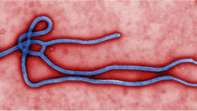 ما-هو-فيروس-الإيبولا؟