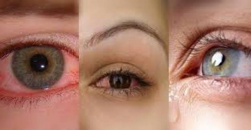 علاجات فعالة لجفاف العين