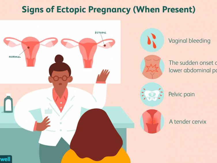 can an ectopic pregnancy be saved 2371464 012 c7665962e4404d5a93423a5f9d810bea