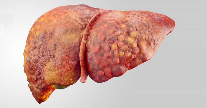 ما هي أعراض دهون الكبد