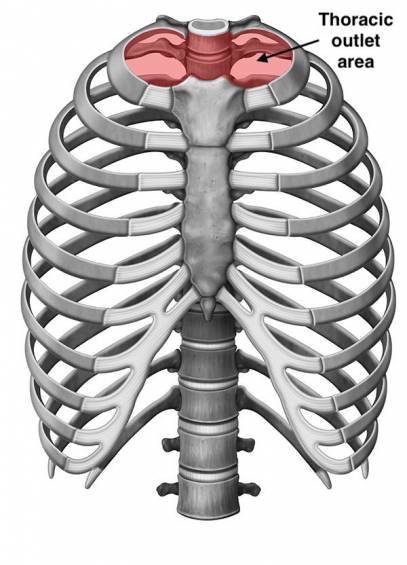 ما هي متلازمة مخرج الصدر؟ 789