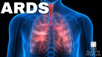 ماذا تعرف عن متلازمة الضائقة التنفسية الحادة ؟ 2