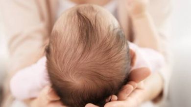 قشرة الشعر عند الرضع